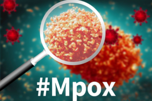 थाइलैंड में पहला मंकी पॉक्‍स का मामला सामने आया