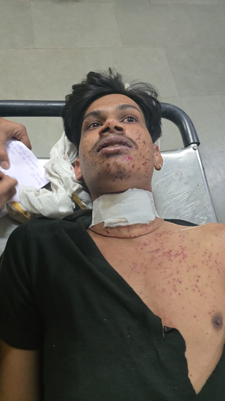 रायपुर स्थित केन्द्रीय जेल के बाहर हुई गोलीबारी की घटना में एक युवक घायल