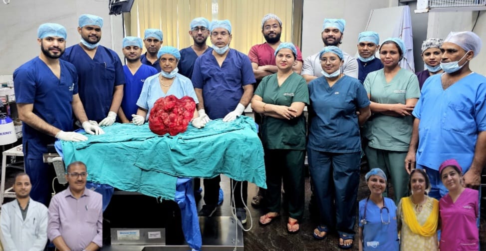 सफदरजंग अस्पताल के डॉक्टरों ने महिला के पेट से 10.5 किग्रा से अधिक का ट्यूमर निकाल कर उसे नई जिंदगी दी