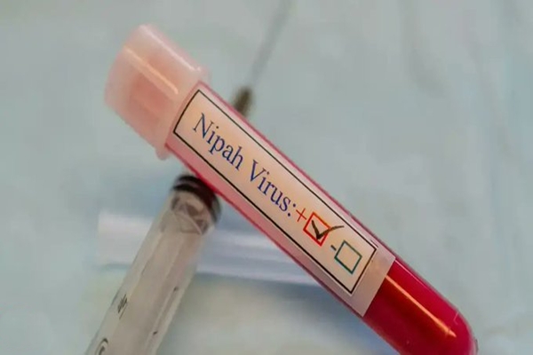 Central teams visit Kerala for Nipah surveillance; 499 under observation