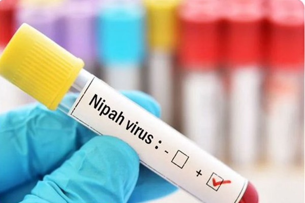 مغربی بنگال میں Nipah Virus کے دو مشتبہ کیس کے منظر عام پر آنے کے بعد حکومت نے ایک مشترکہ قومی آؤٹ بریک رِسپانس کے بعد ریاست کو اس کی روک تھام کی مدد کیلئے تعینات کیا ہے